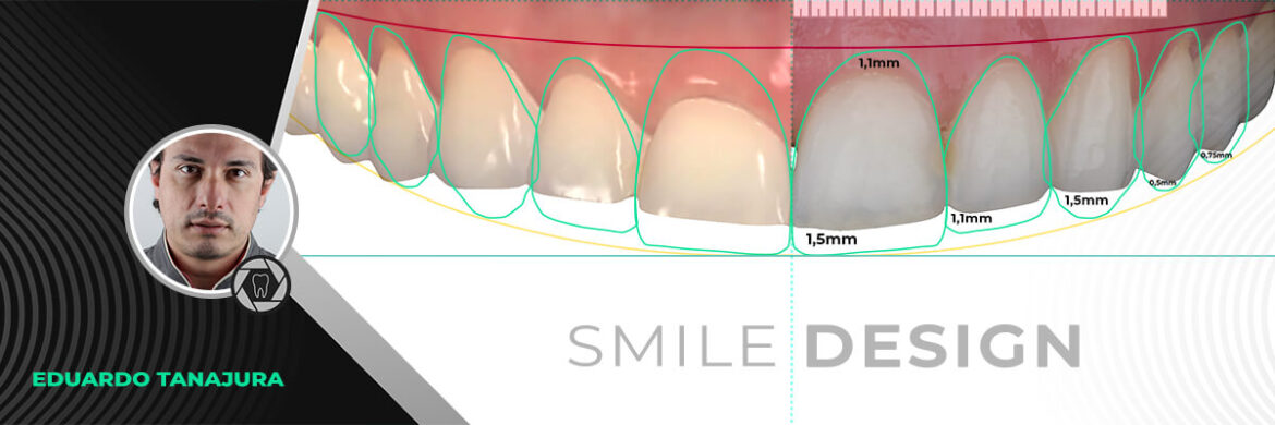 Especial Smile Design
